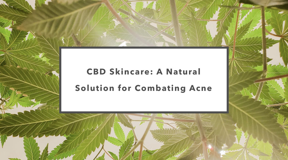 CBD Skincare: A Natural Solution for Combating Acne