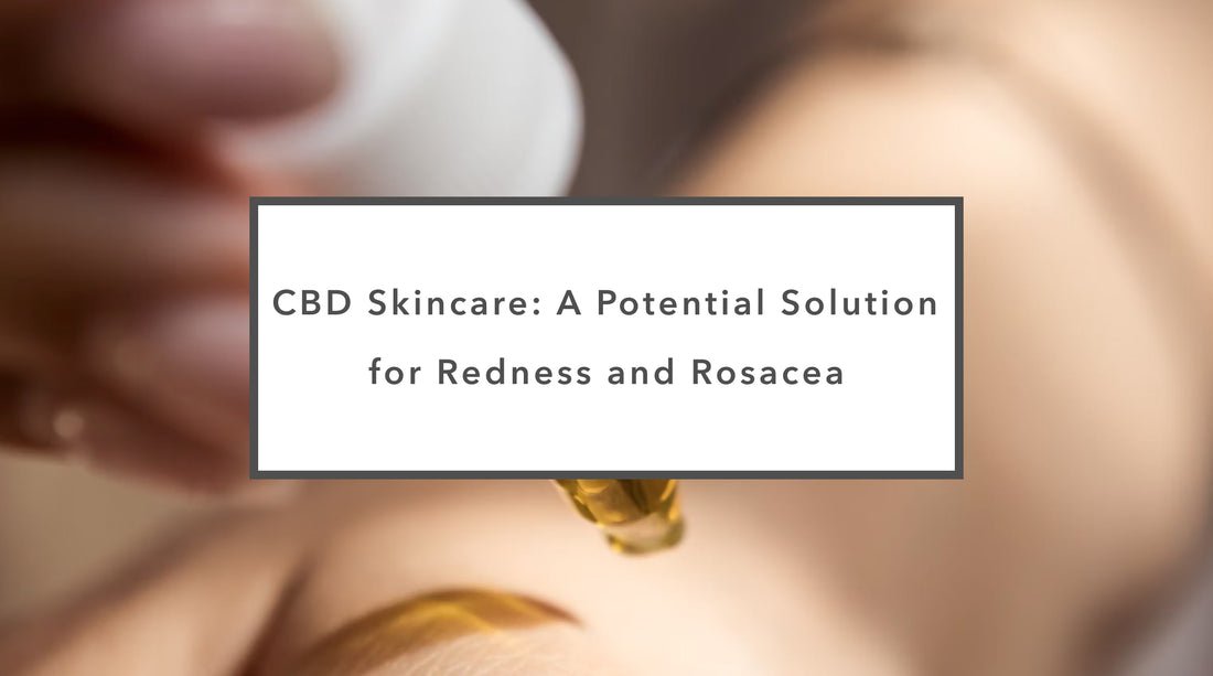 CBD Skincare: A Potential Solution for Redness and Rosacea